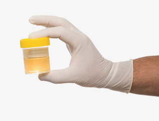 প্রস্রাব বা ইউরিন টেস্ট (Urine Test) কেন করা হয়?