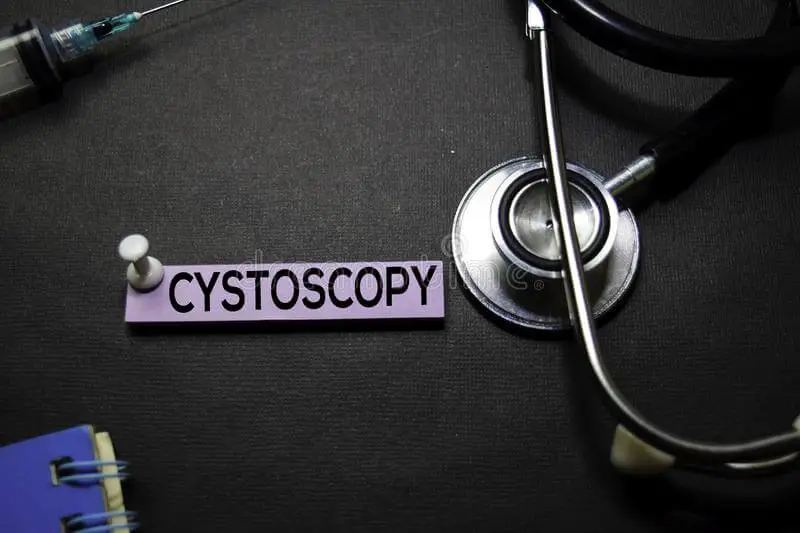 সিসটোস্কোপি (Cystoscopy) টেস্ট কি ও কেন করা হয়?