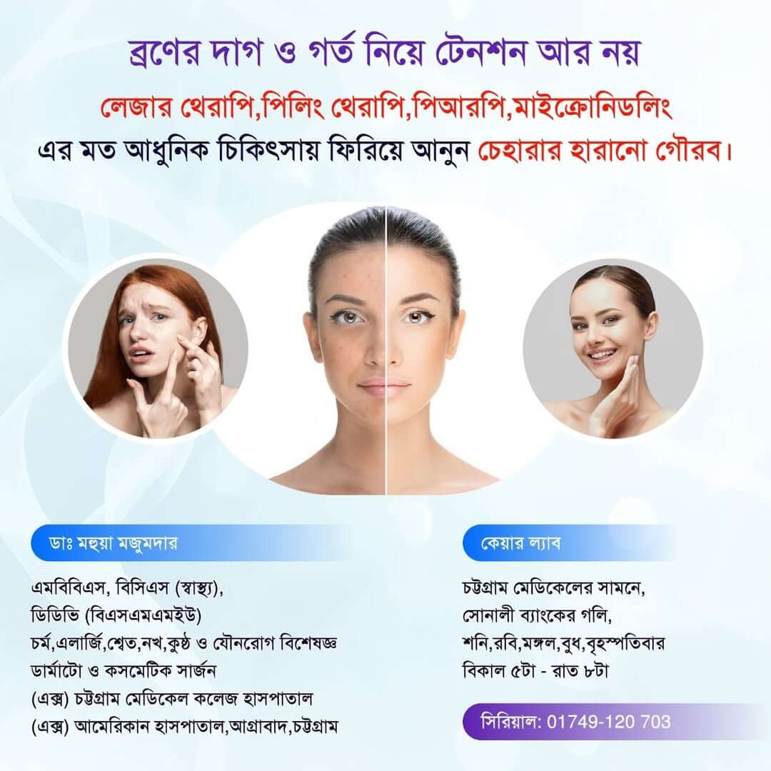 Advertisement