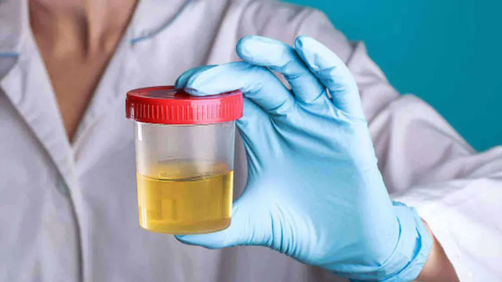 প্রস্রাব গরম হওয়ার কারণ কি